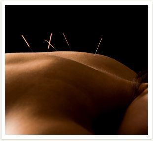 img_acupuncture